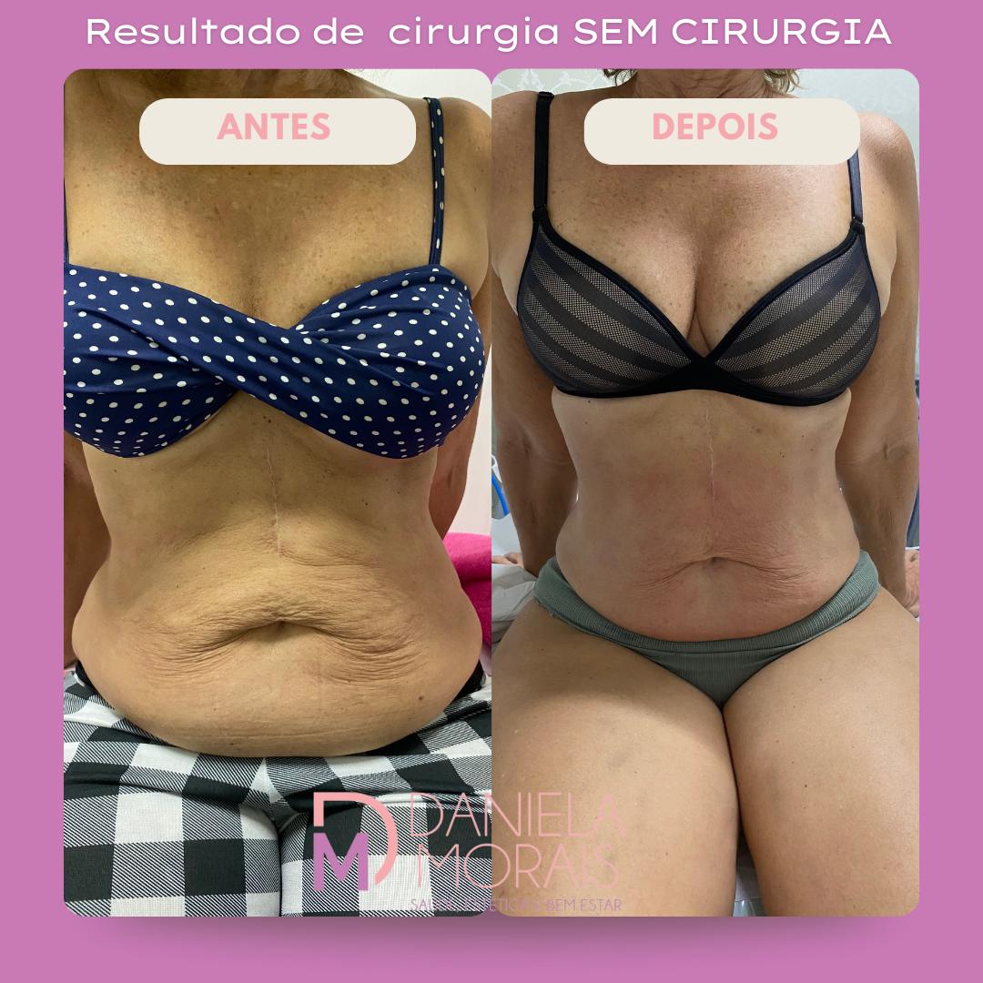 WhatsApp Image 2026-01-08 at 08.11.24